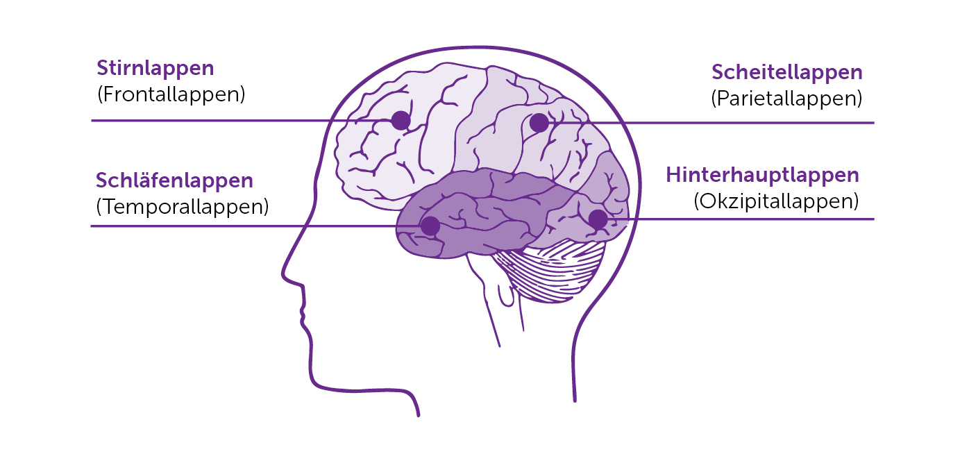 Bei der fokalen Epilepsie können verschiedene Bereiche des Gehirns betroffen sein.