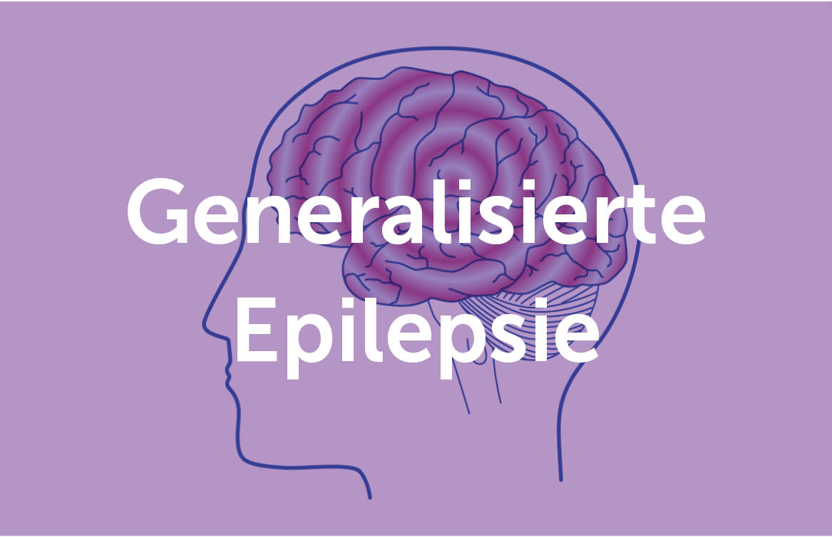 Illustration einer generalisierten Epilepsie